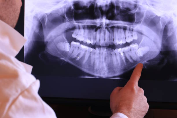 Best Emergency Dental Services for Seniors in Lena, IL