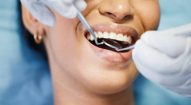 Best Emergency Dentist for Lost Fillings or Crowns in Lena, IL